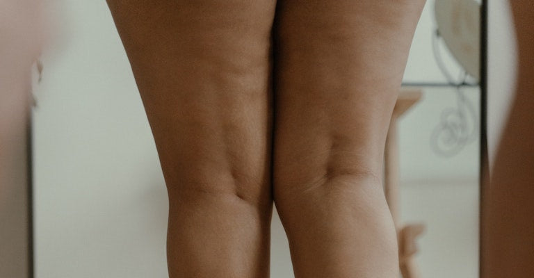 Thigh Chafing: What Causes It and How to Avoid It