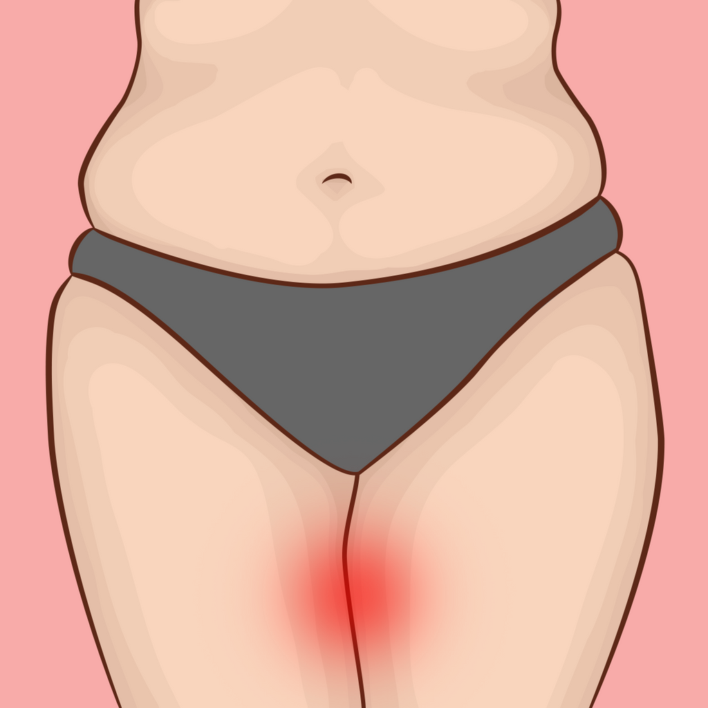 Your Ultimate Guide To Preventing And Treating Thigh Chafing